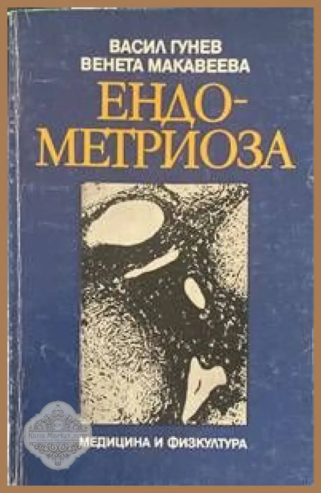 Ендометриоза - Васил Гунев Венета Макавеева - Книги