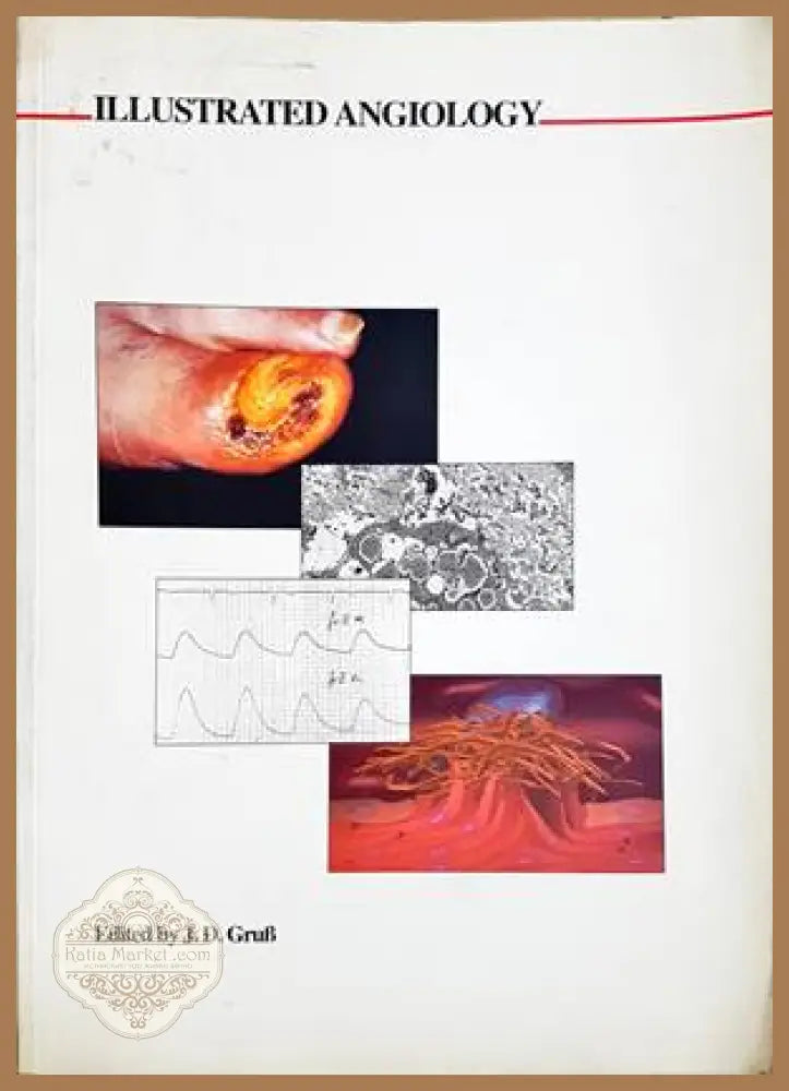 Illustrated Angiology - J. D. Gruss