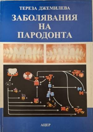Заболявания на пародонта - Тереза Джемилева