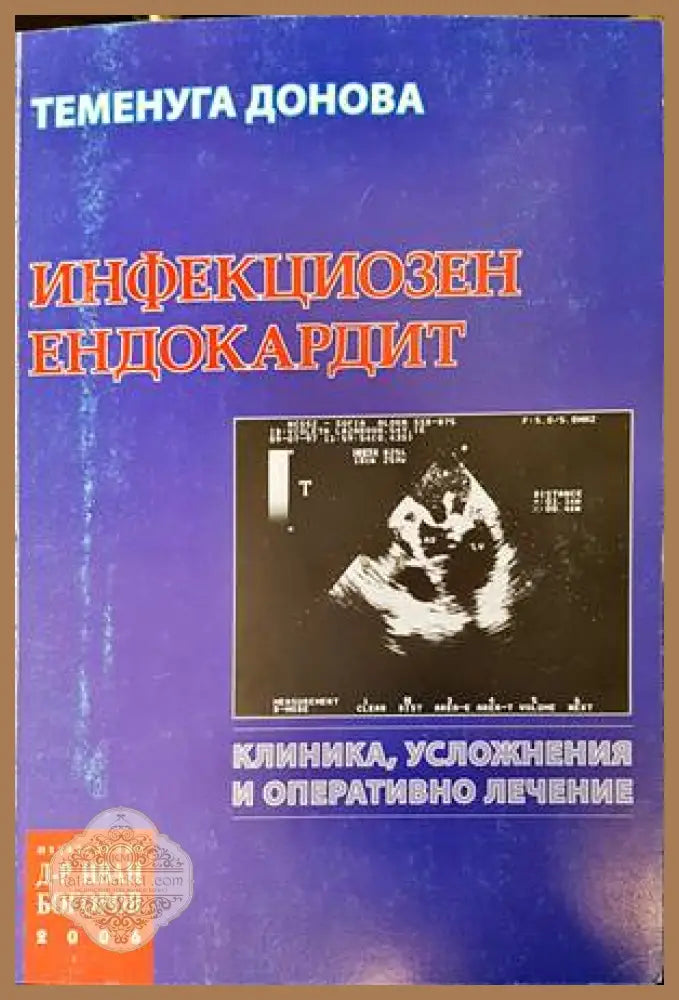 Инфекциозен ендокардит - Теменуга Донова - Книги