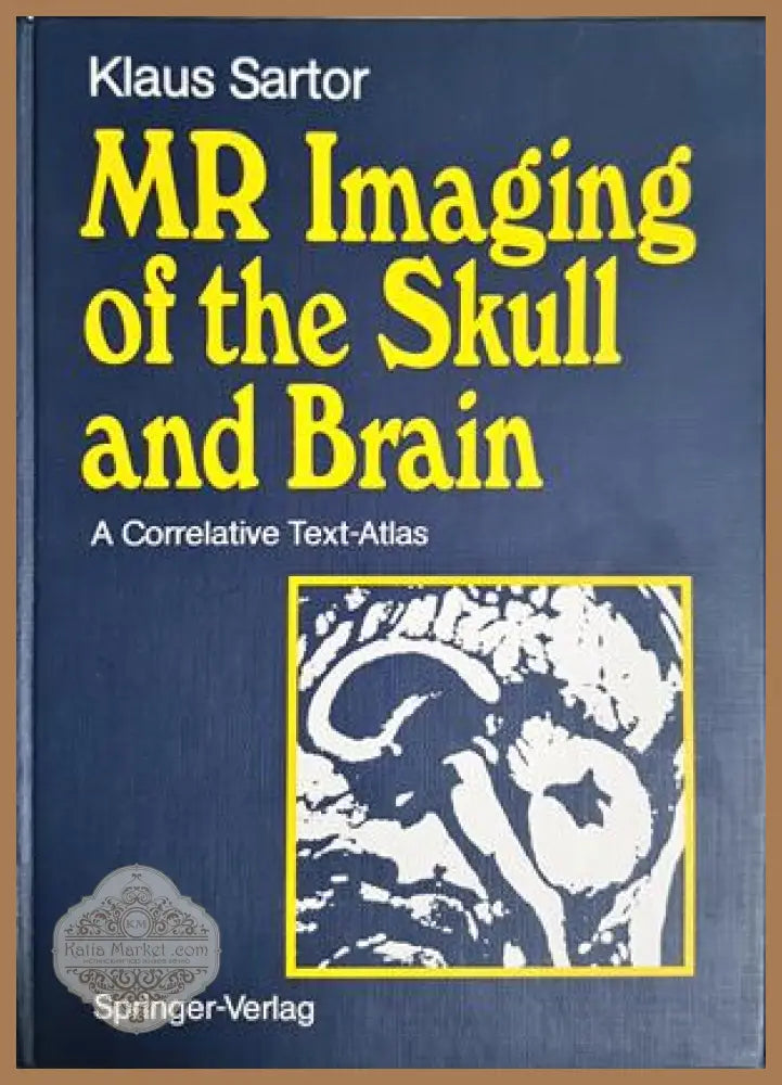 MR Imaging of the Skull and Brain – Klaus Sartor