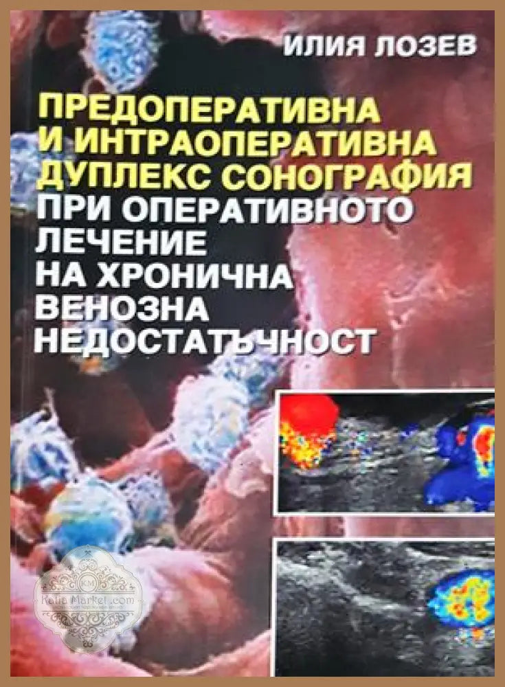 Предоперативна и интраоперативна дуплекс сонография - корица