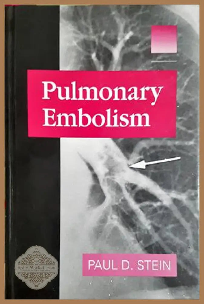 Pulmonary Embolism - Paul D. Stein - корица