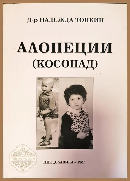 Алопеции косопат - Надежда Тонкин - Книги