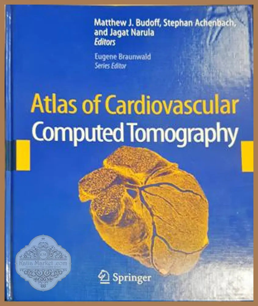 Atlas of Cardiovascular Computed Tomography – Budoff, Achenbach, Narula