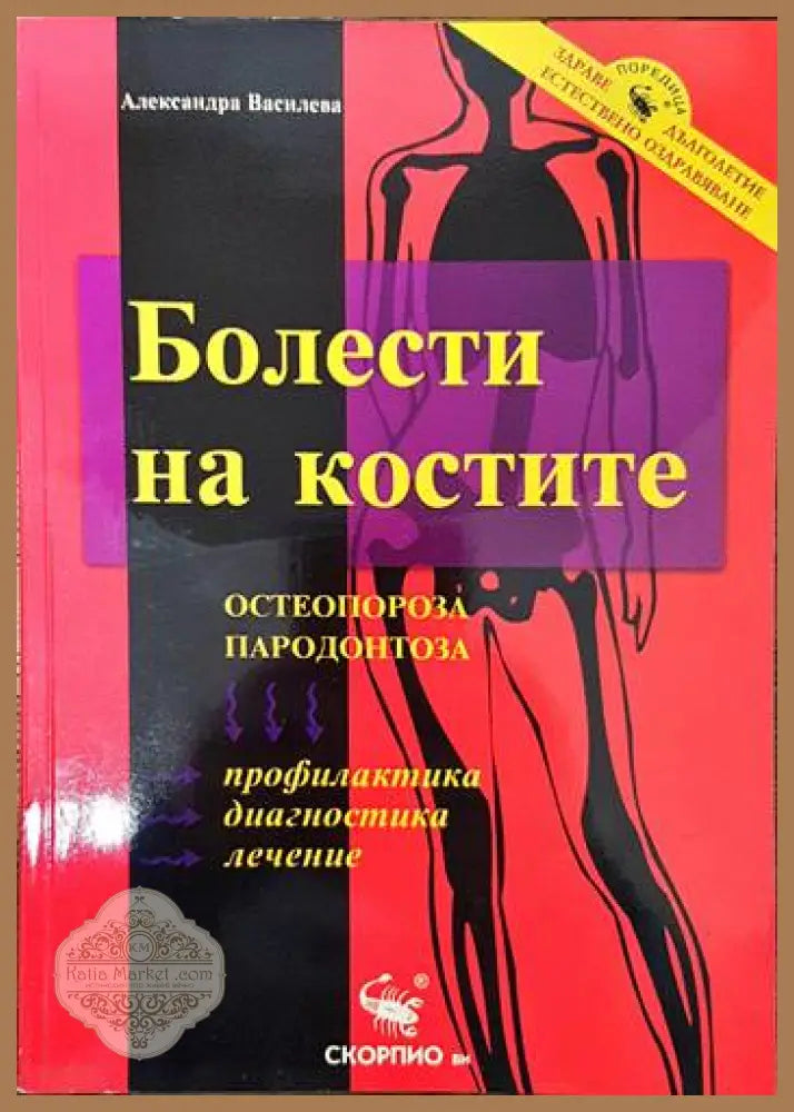 Болести на костите: Остеопороза пародонтоза - Александра Василева - Книги