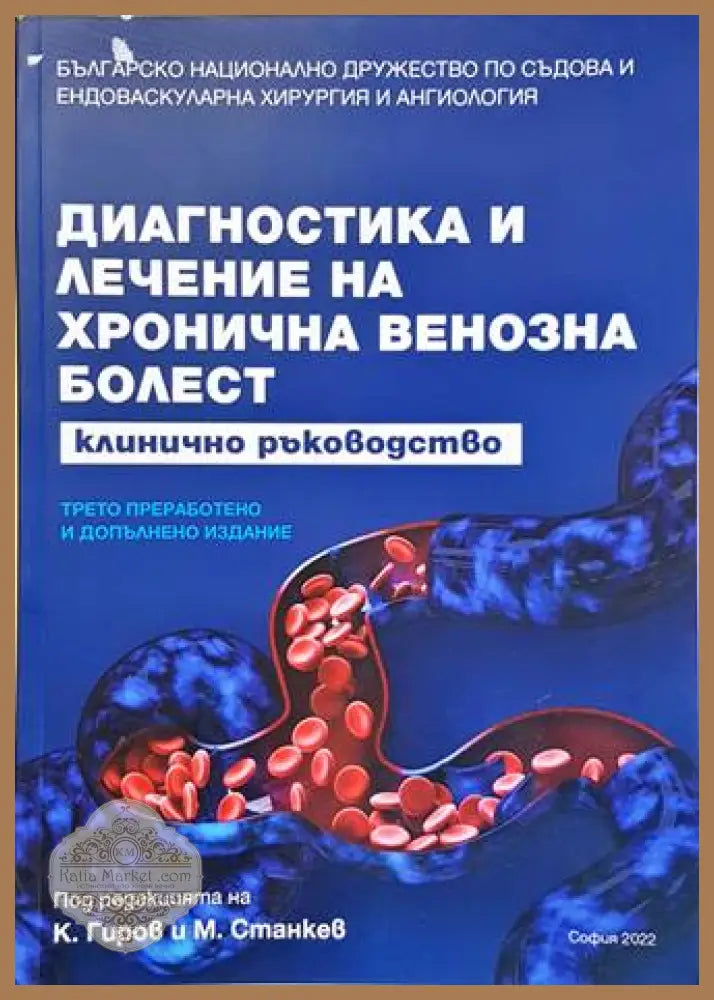 Диагностика и лечение на хронична венозна болест
