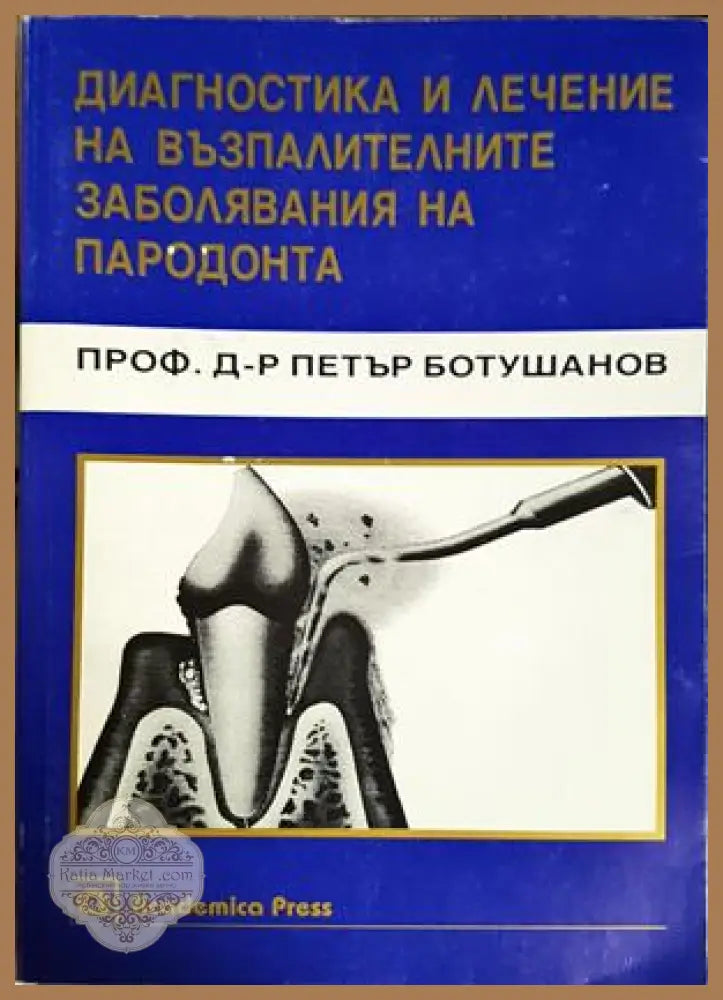 Диагностика и лечение на възпалителните заболявания на пародонта