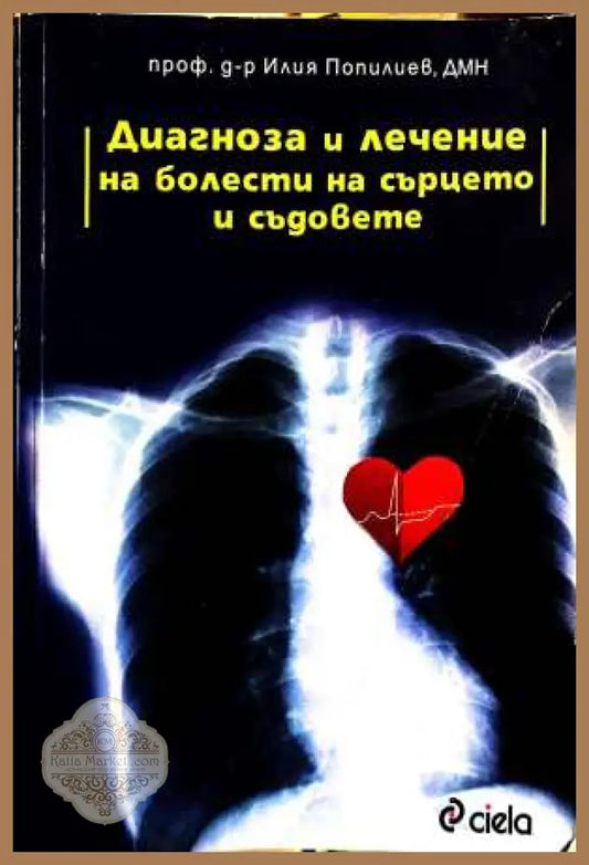 Диагноза и лечение на болести на сърцето и съдовете - Илия Попилиев