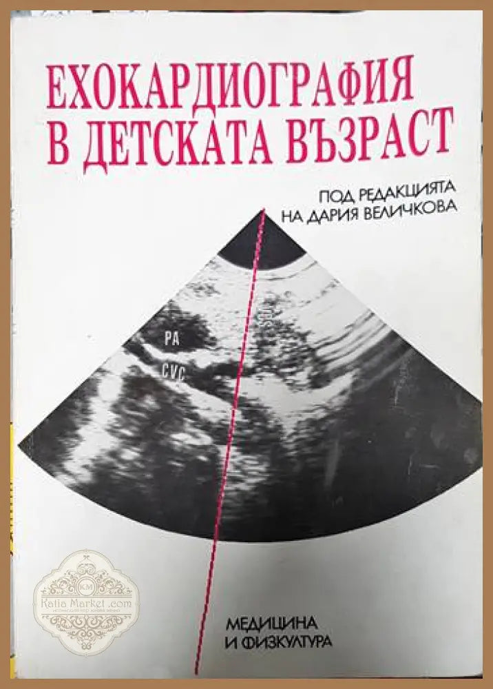 Ехокардиография в детската възраст - Иван Велковски Никола Арнаудов - Книги