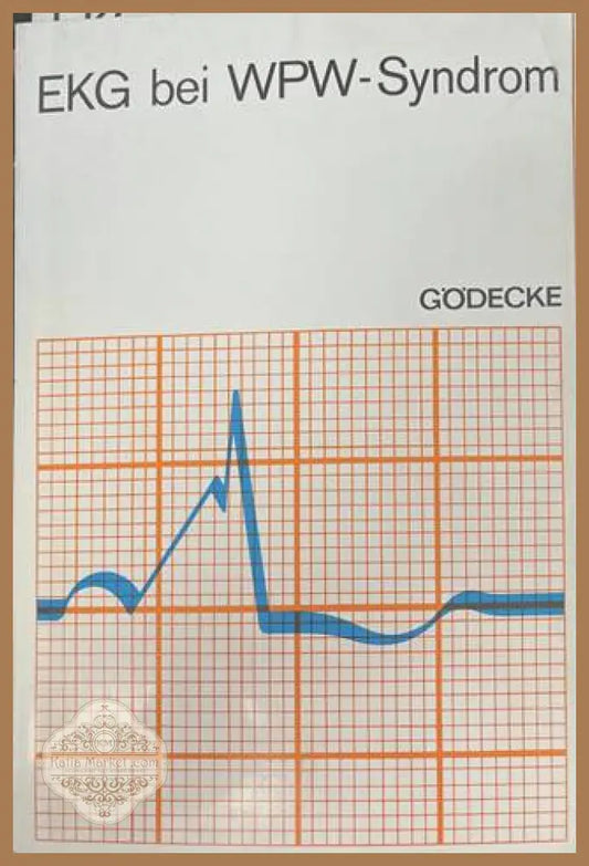 EKG bei WPW-Syndrom - корица