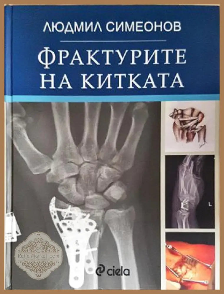 Фрактурите на китката - Людмил Симеонов - Книга