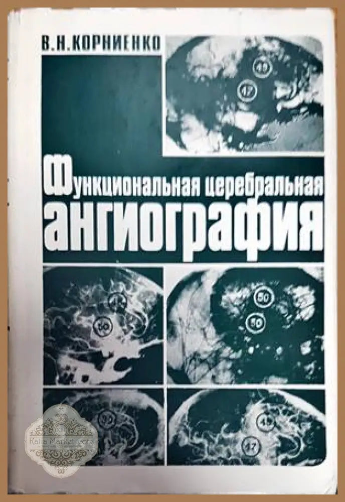Функциональная церебральная ангиография - В. Н. Корниенко - Книги