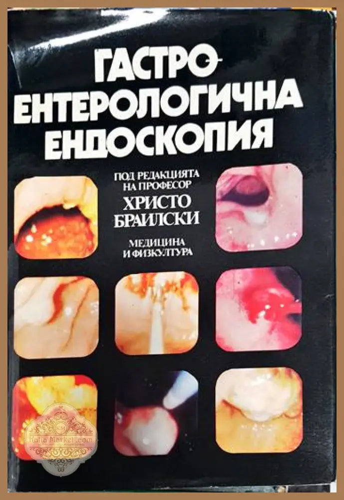 Гастроентерологична ендоскопия - Христо Браилски - Книга