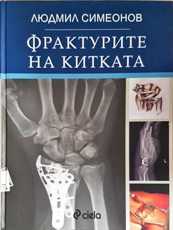 Фрактурите на китката - Людмил Симеонов