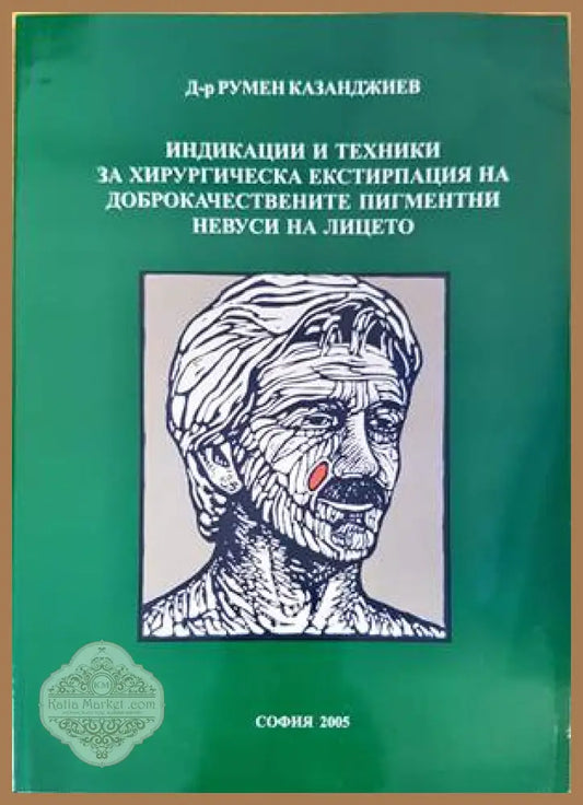 Индикации и техники за хирургическа екстирпация на доброкачествените пигментни невуси на лицето - Румен Казанджиев
