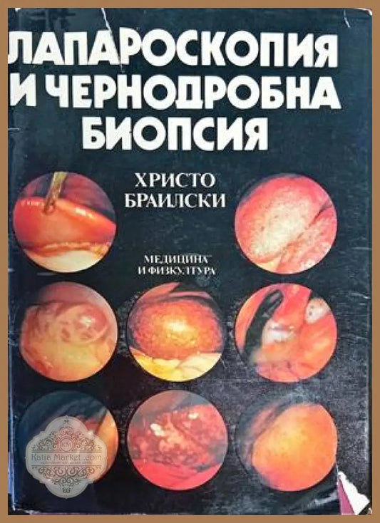 Лапароскопия и чернодробна биопсия - Христо Браилски - Книги