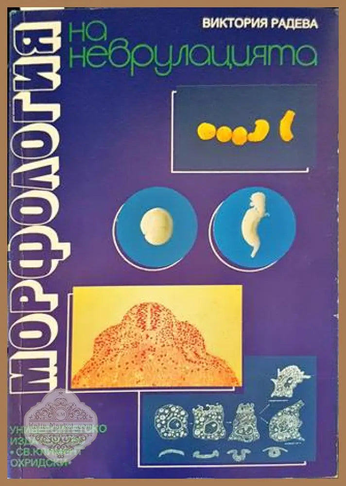 Морфология на неврулацията - Виктория Радева - Книги