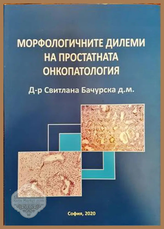 Морфологичните дилеми на простатната онкопатология - Свитлана Бачурска - Книги