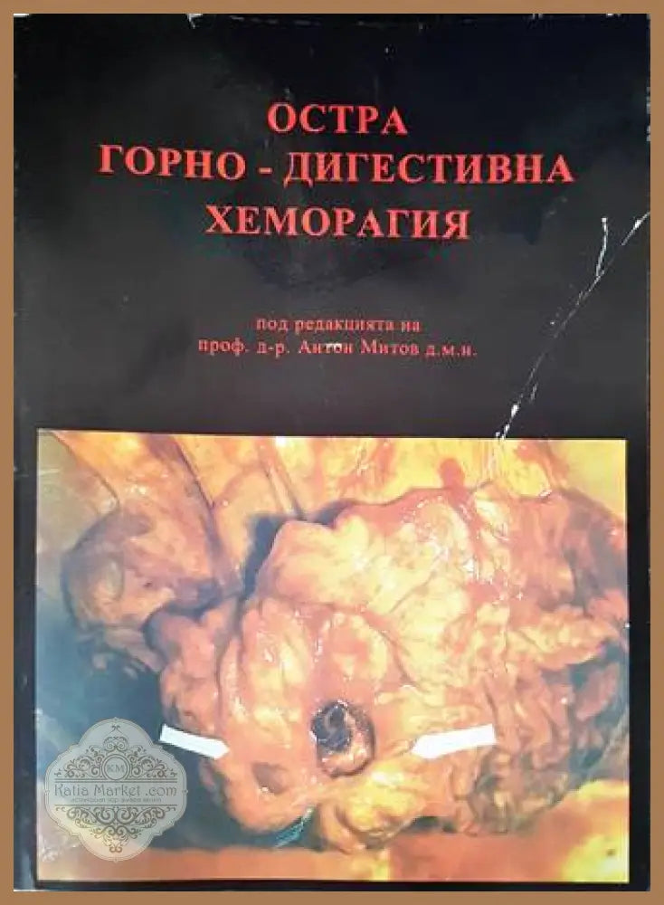 Остра горно-дигестивна хеморагия - Колектив - Книги