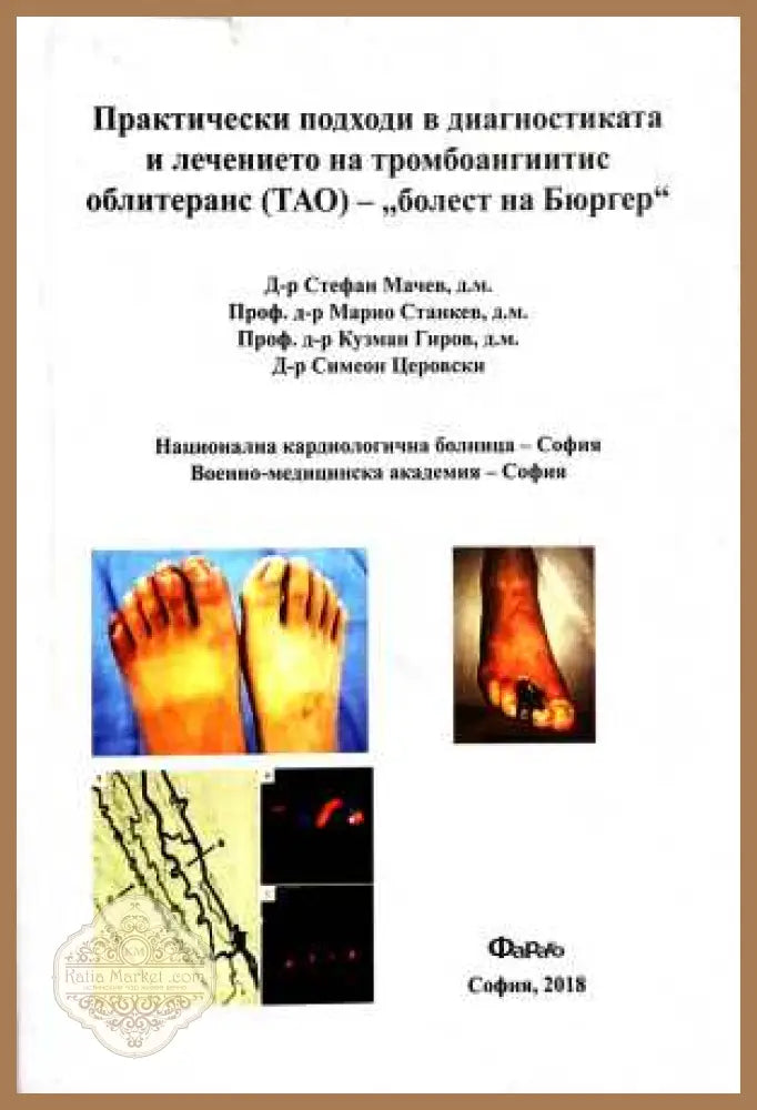 Практически подходи ТАО - болест на Бюргер