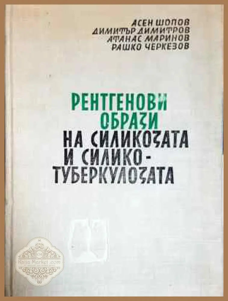 Рентгенови образи на силикозата и силикотуберкулозата - Асен Шопов Димитър Димитров Атанас Маринов Рашко Черкезов