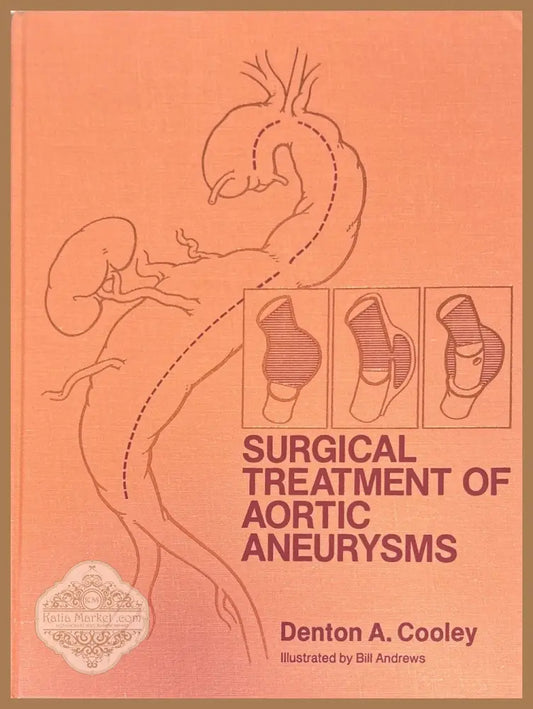 Surgical treatment of aortic aneurysms - Denton A. Cooley - Книги
