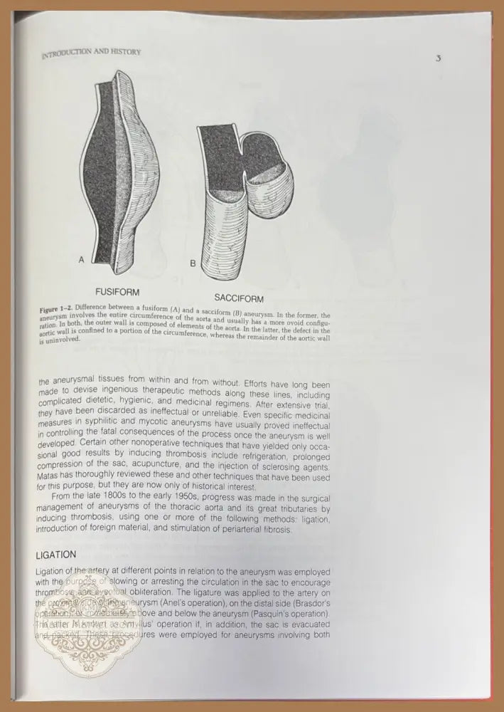 Surgical treatment of aortic aneurysms - Denton A. Cooley - Книги