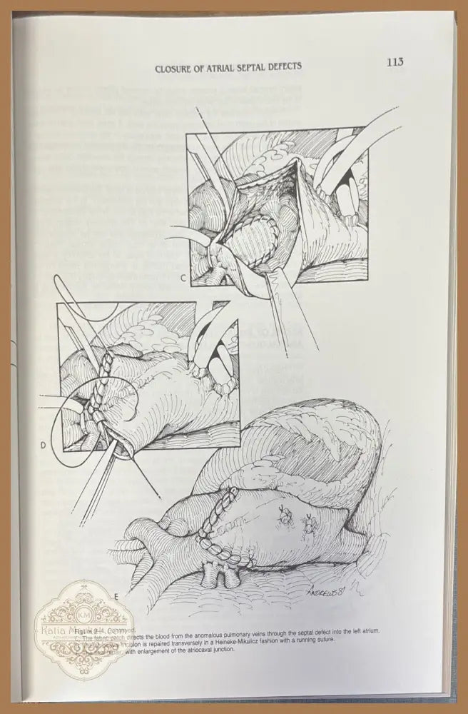 Techniques in cardiac surgery. Second edition - Denton A. Cooley - Книги