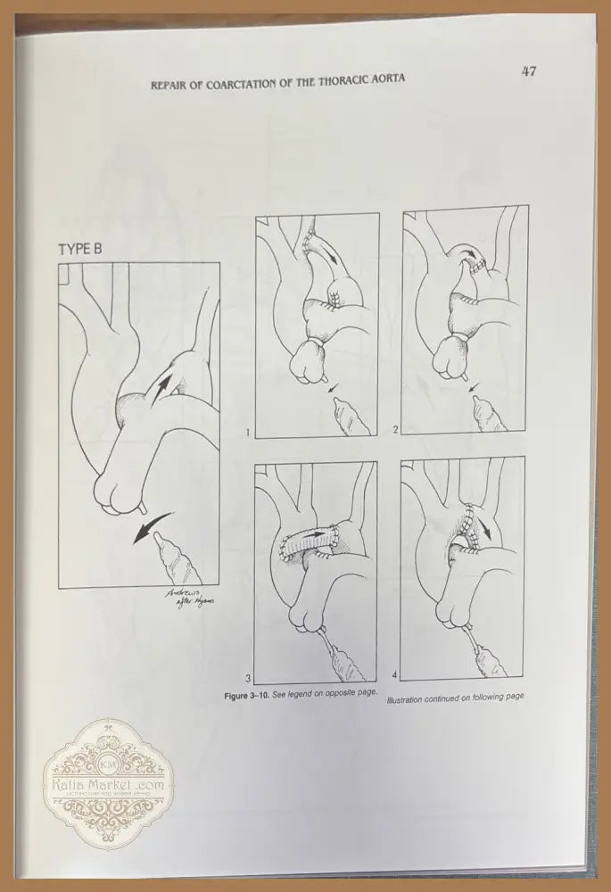 Techniques in cardiac surgery. Second edition - Denton A. Cooley - Книги