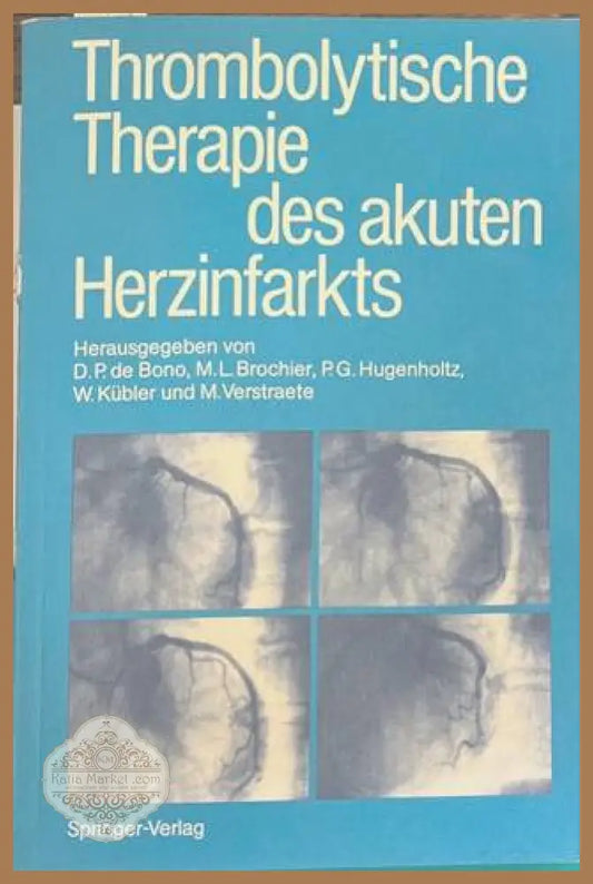Thrombolytische Therapie des akuten Herzinfarkts - Springer-Verlag