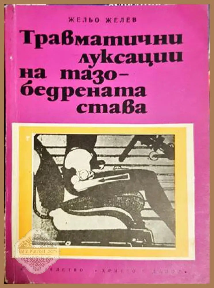 Травматични луксации на тазобедрената става