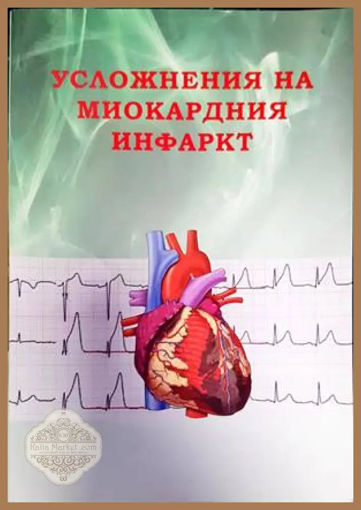 Усложнения на миокардния инфаркт - Нина Гочева Елина Трендафилова - Книги