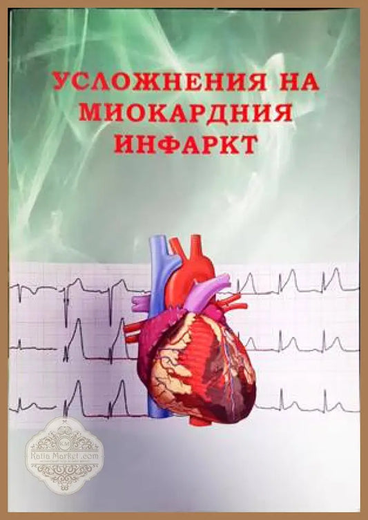 Усложнения на миокардния инфаркт - Нина Гочева Елина Трендафилова - Книги