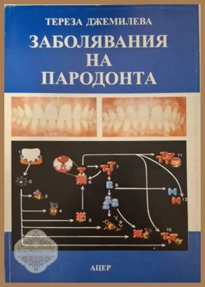 Заболявания на пародонта - Тереза Джемилева - Книга