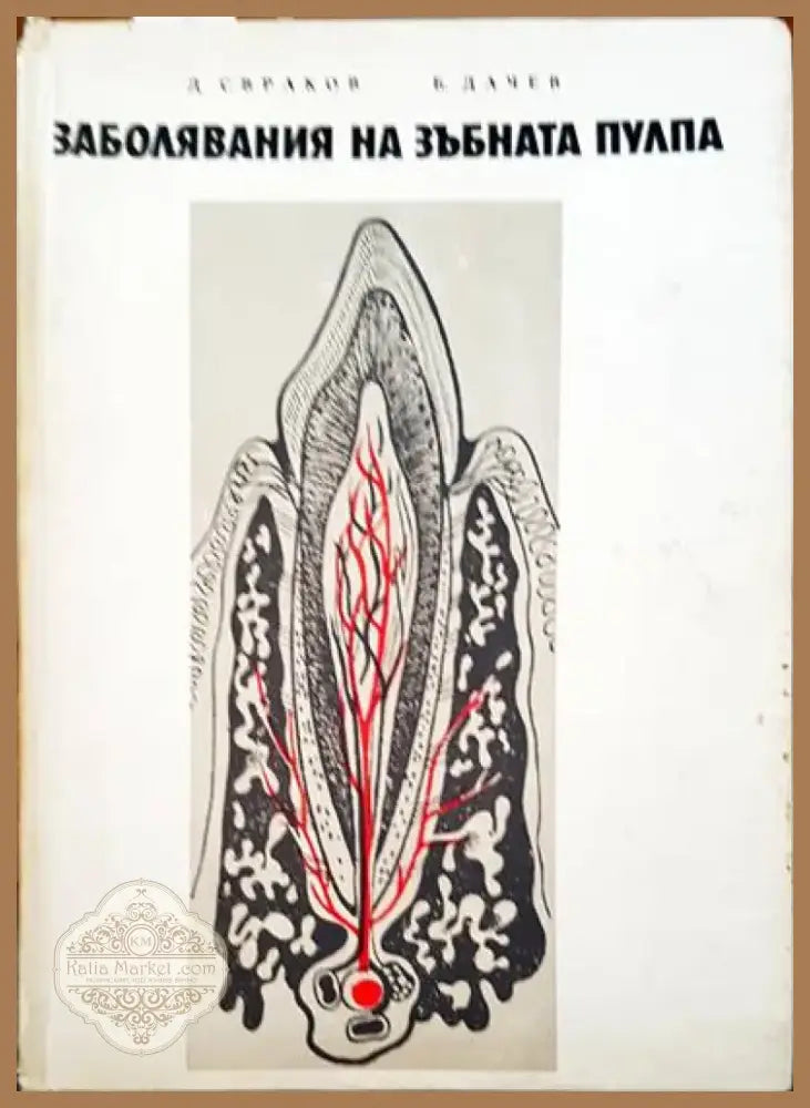 Заболявания на зъбната пулпа (471) - Книга