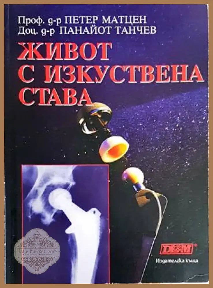 Живот с изкуствена става (1340) - Книга