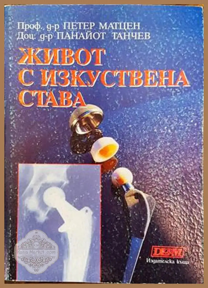 Живот с изкуствена става - Петер Матцен Панайот Танчев - Книги